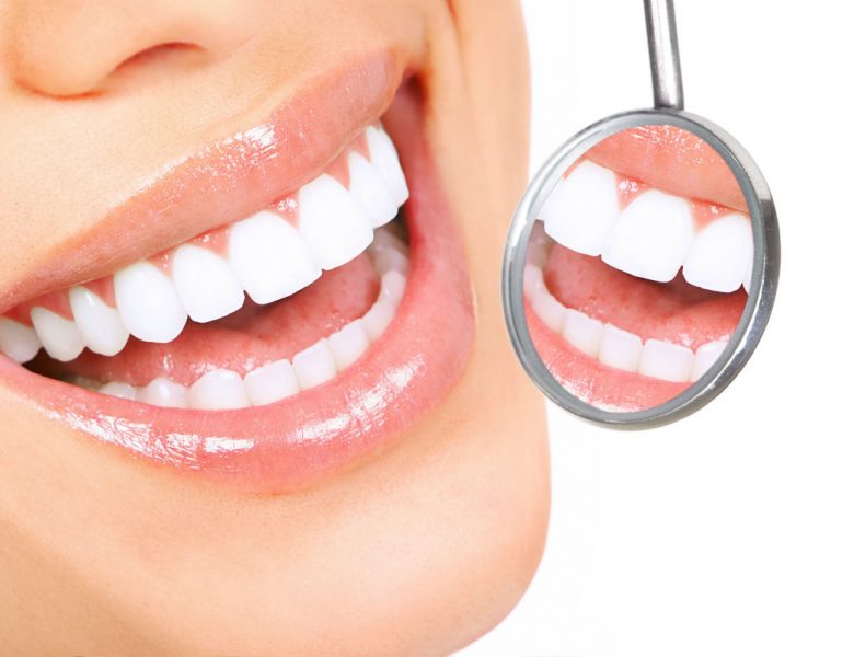 Diş Çarpıklığı Nasıl Tedavi Edilir?