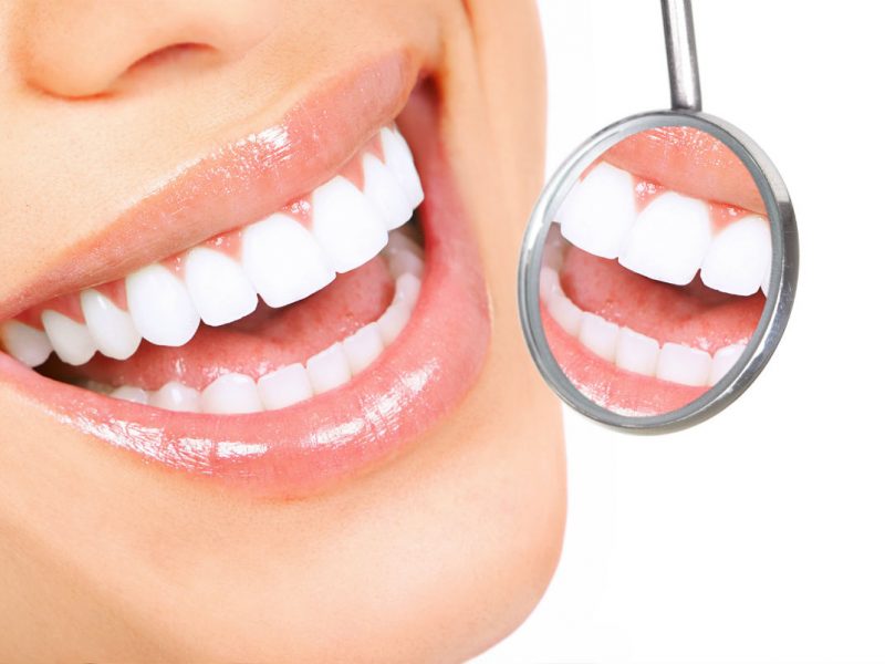 Diş Çarpıklığı Nasıl Tedavi Edilir?