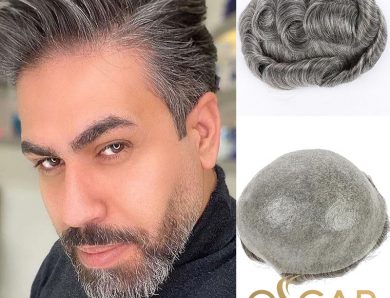 Saç Dökülmelerine Karşı Oscar Hair’de Protez Saç Ekimi